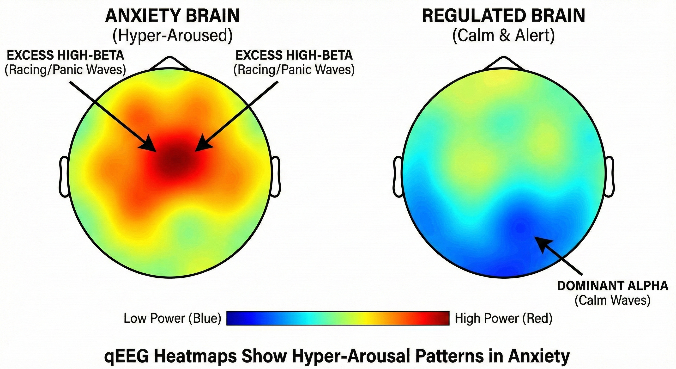 Counseling for anxiety in Utah
